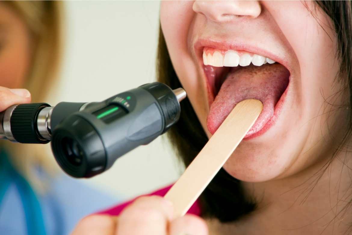 Qué enfermedades puedes tener según la apariencia de tu lengua